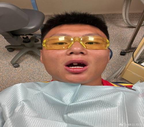 真的拼！方昊在亚运队对阵新西兰U22比赛中断了四颗牙