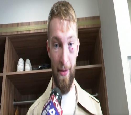 左眼肿胀明显！小萨：为全队惊叹的表现自豪迫不及待回主场打G7