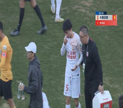 李申圆确诊鼻骨骨折，比赛中被蒂亚戈击中鼻子血流不止