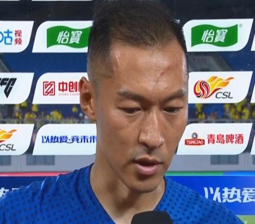 额头“挂彩”出现五六厘米长血痕,吴曦:我也不知道什么时候伤的