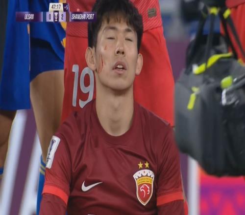 破相了!杨世元脸上被划开了一道口子,队医进场还吃了黄牌